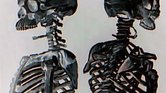 Duo skeletons...