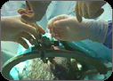 Injecting embryonic cells into the brain of a stroke victim