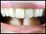 Mouth