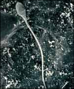 Sperm