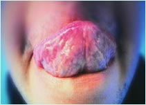 Mouth and tongue