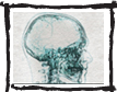 x-ray of human skull