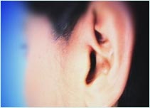Ear