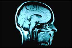 Brain scan