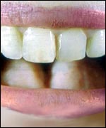 Mouth