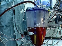 Heart Lung machine