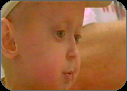 Ory Barnett who suffers from Progeria