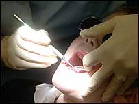 Child at dentist